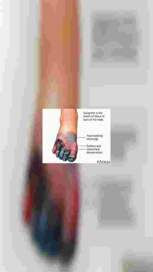 mobile.jpeg